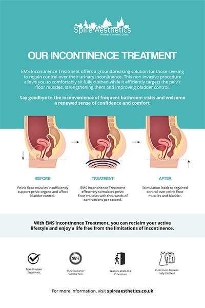 image to show how EMS treatment works for female urinary incontinence Langside