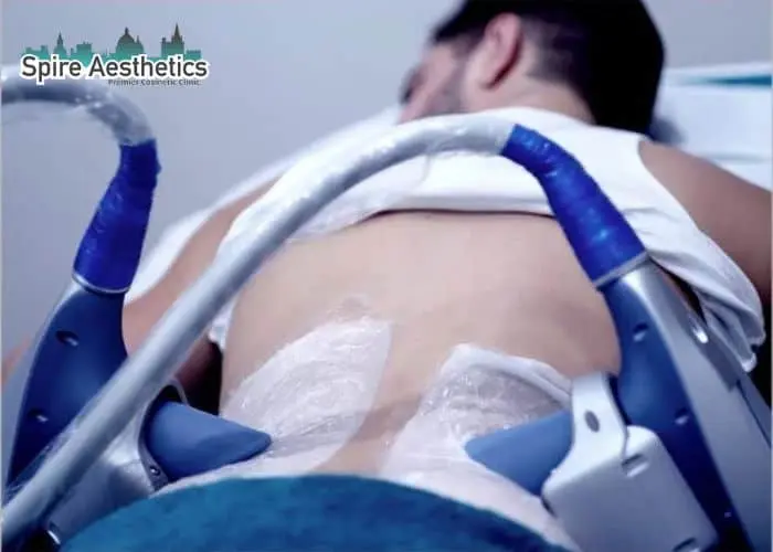 Man having fat freezing treatment done on love handles before a competitions Langside to create a sculpted look.